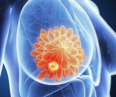 Improving-the-prediction-of-treat5x4ment-response-in-breast-cancer